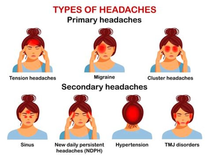 What does a hormonal headache feel like?