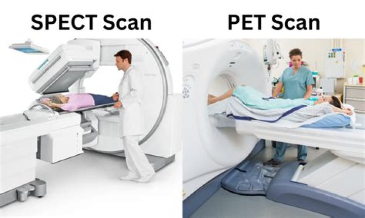What does a Spect CT scan show