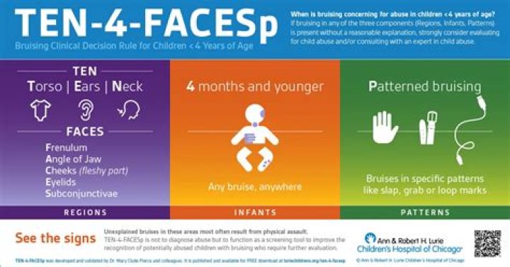 What does Facep mean in medicine?