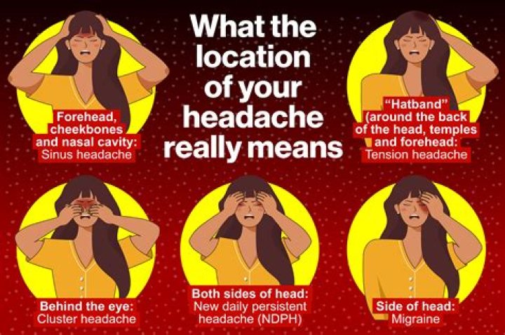 What does IIH headache feel like?
