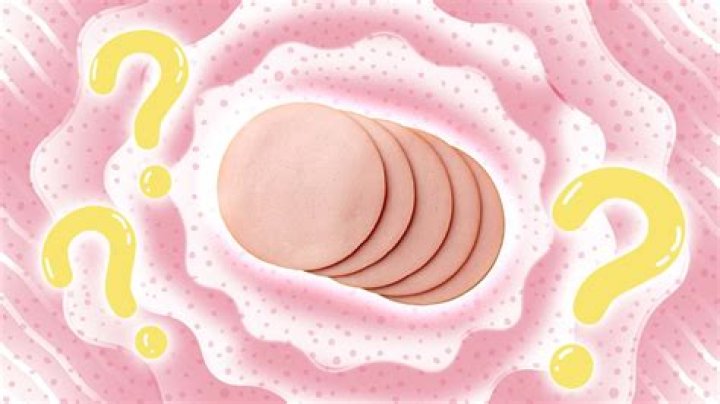 What exactly is race