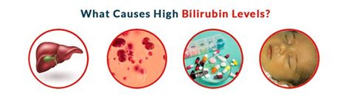 What if indirect bilirubin is high
