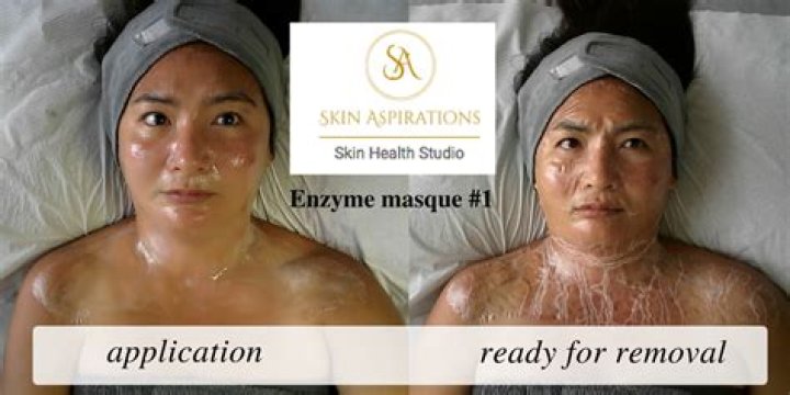 What is a DMK facial