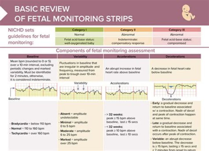 What is a reactive fetal monitor strip