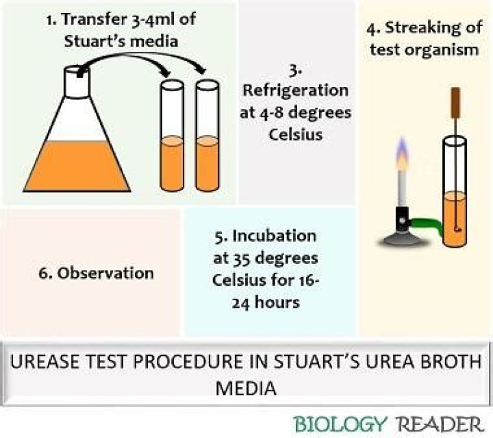 What is a urease test used for