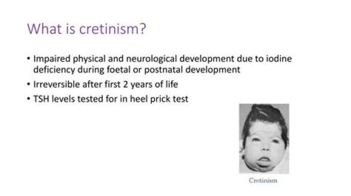 What is cretinism?