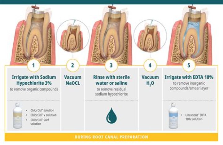 What is eugenol in dentistry