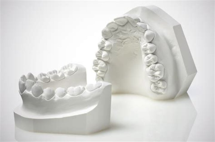 What is gypsum used for in dentistry?