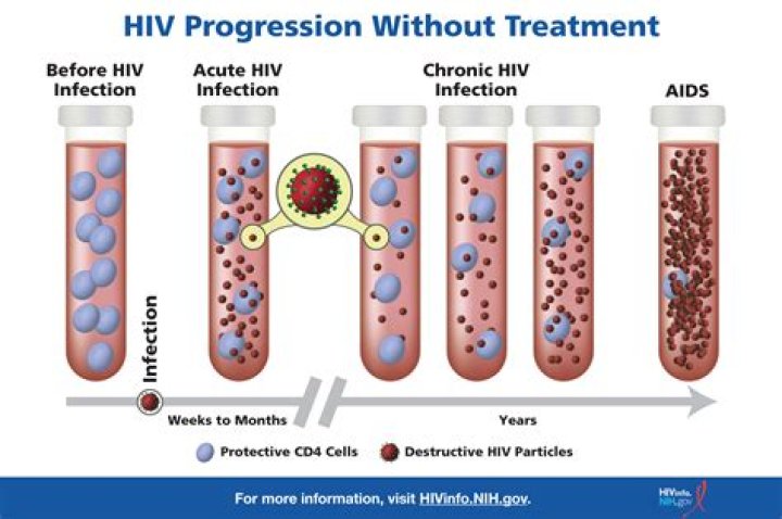 What is HIV 2 antibody