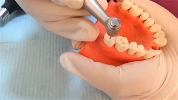 What is op in dental