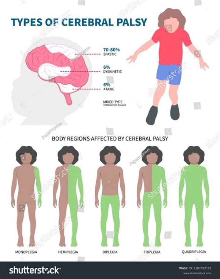 What is quadriplegic cerebral palsy