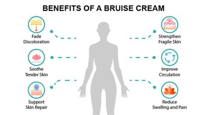 What is the best bruise cream