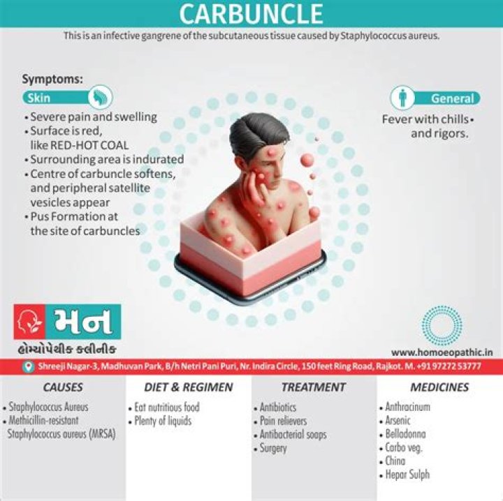 What is the cause of carbuncles