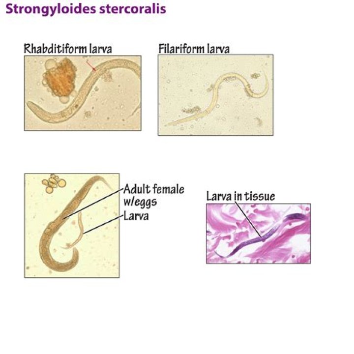 What is the infective stage of Strongyloides stercoralis?