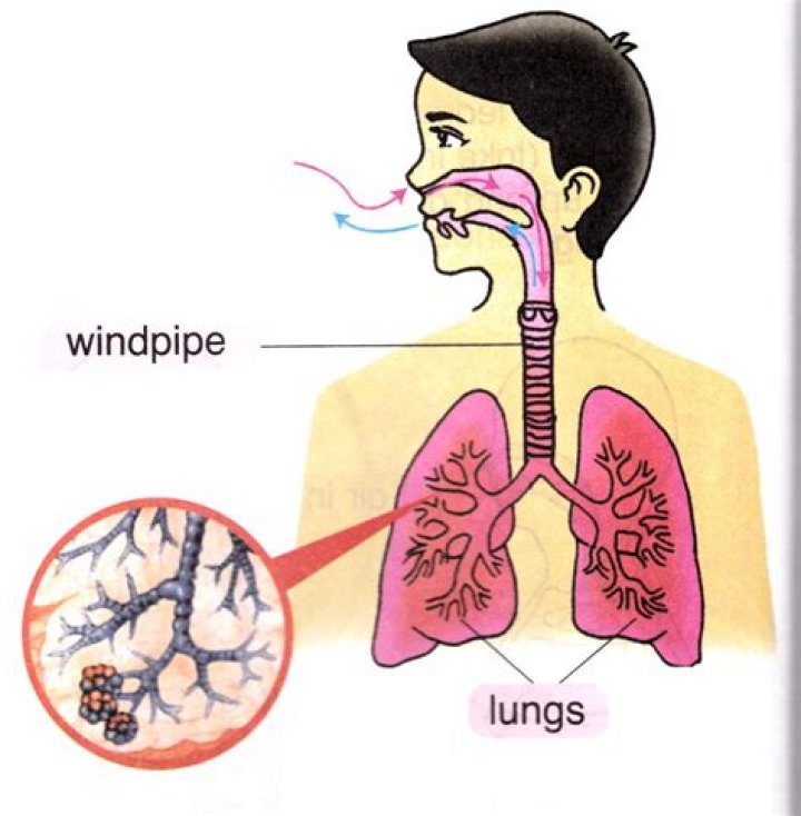 What is the opening of windpipe into pharynx called