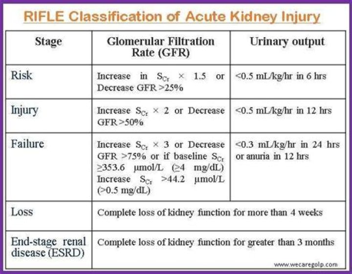 What is the RIFLE criteria for acute kidney injury?