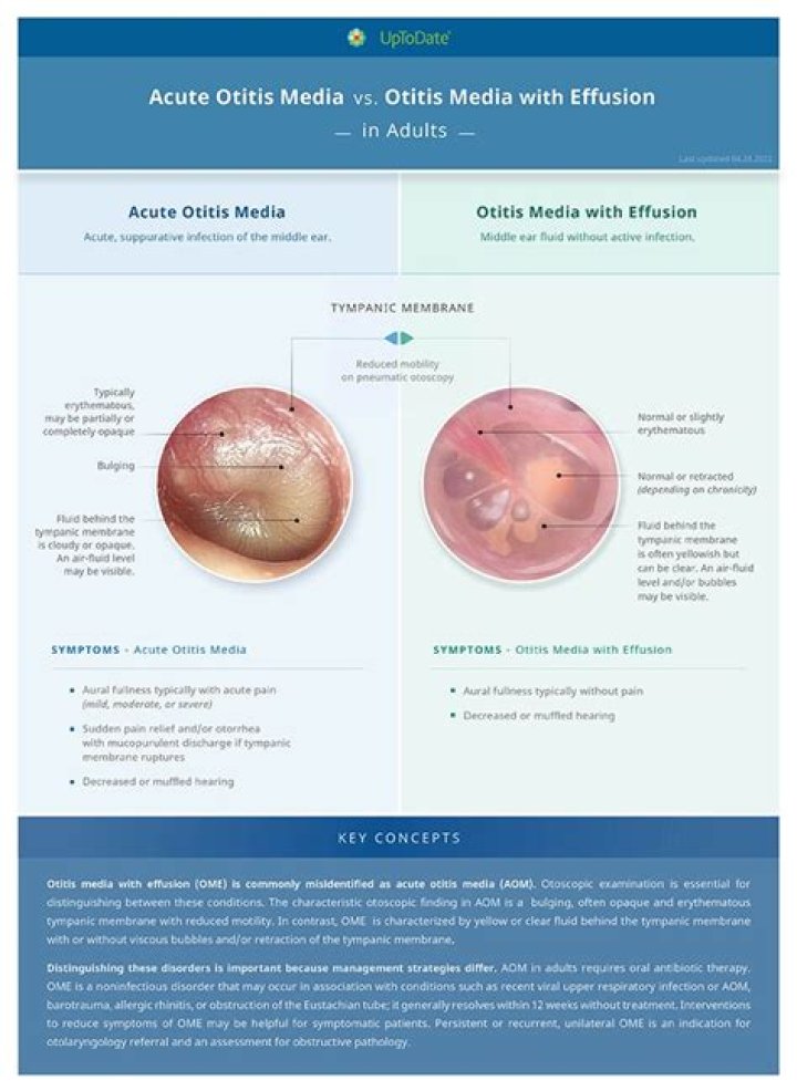 What is the treatment for chronic otitis media
