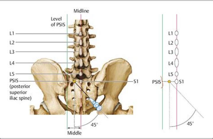 What level is PSIS at