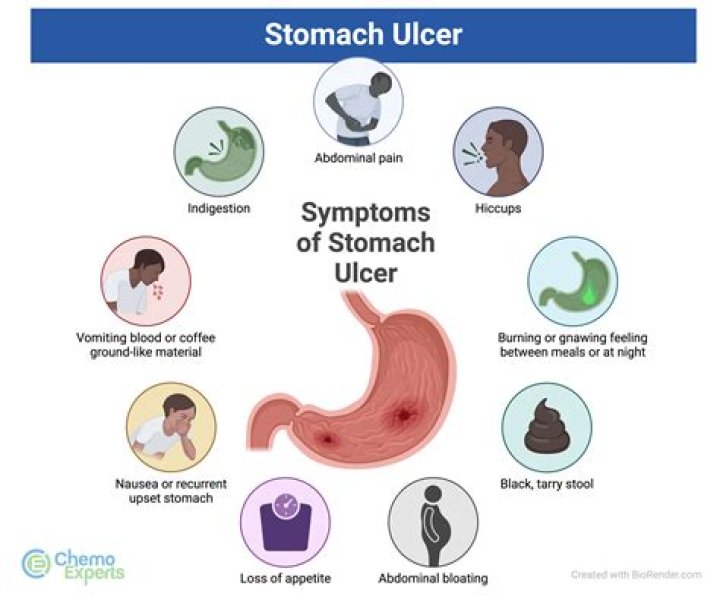 What should I eat if I have a peptic ulcer