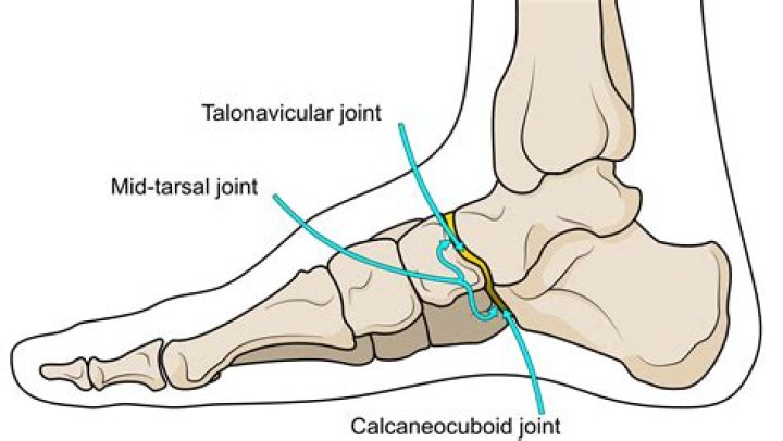What type of joint is the Talonavicular?