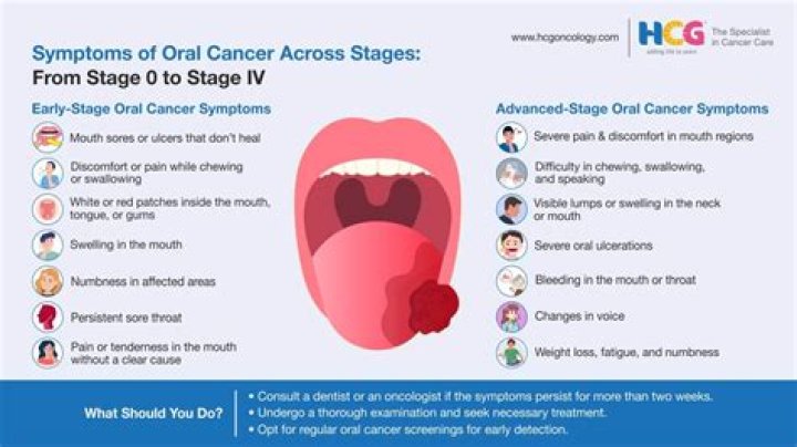 Where does base of tongue cancer spread