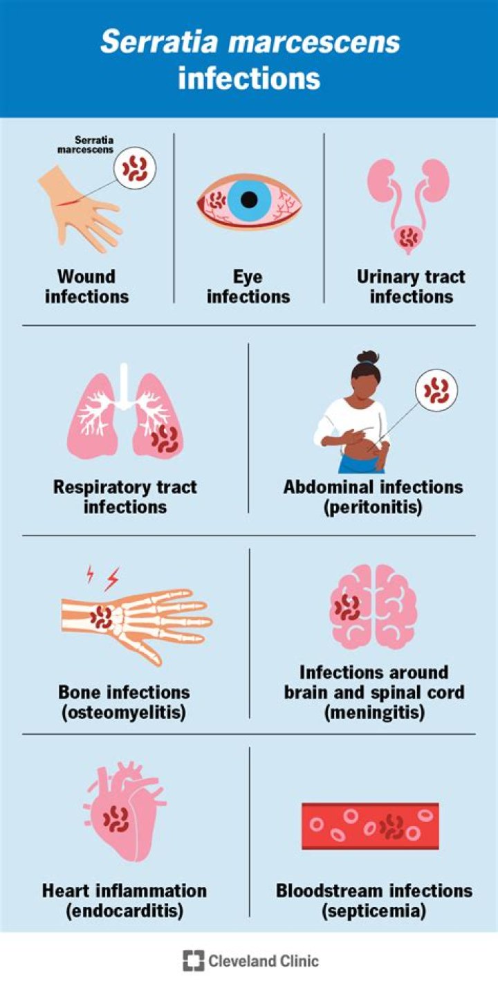 Where does Serratia marcescens bacteria come from?