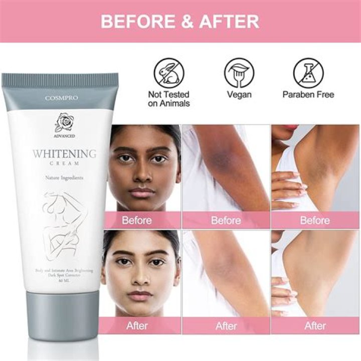 Which is the best whitening cream for face in Pakistan?