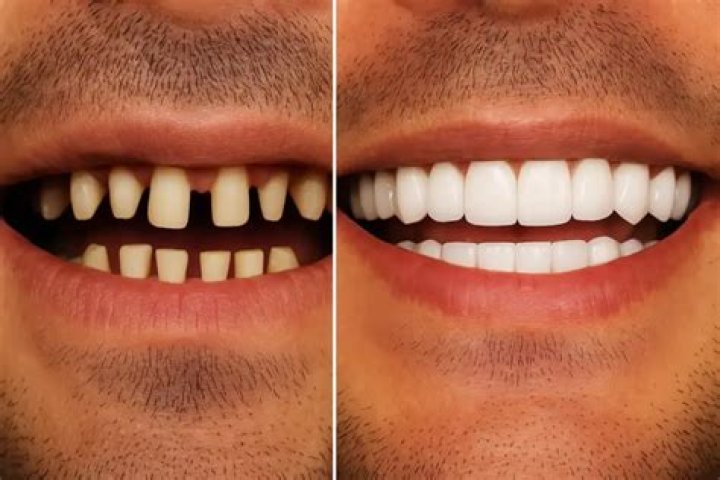 Why do humans show teeth when smiling?
