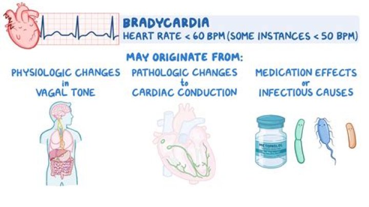 Why does hypothermia cause bradycardia