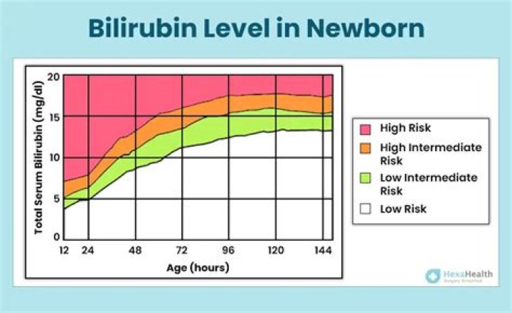 Why does my babys bilirubin keep going up