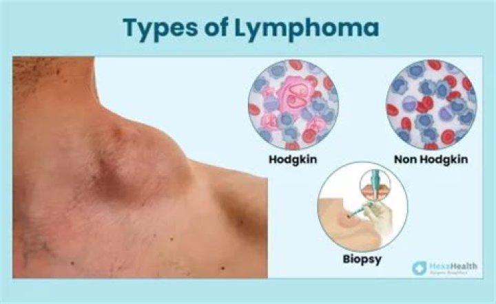 Why is indolent lymphoma not curable?
