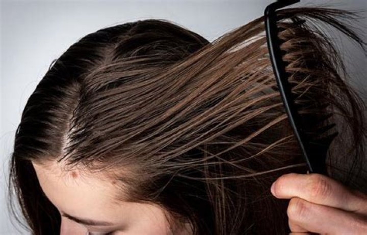 Why is my hair so greasy?